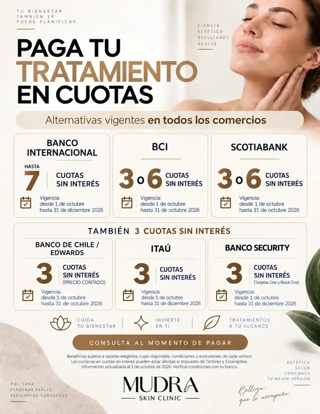 Cuotas sin Interes