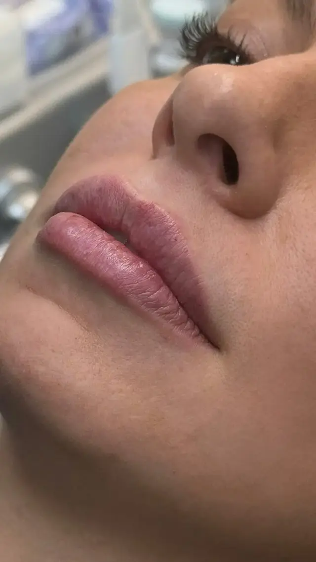 Labios más gruesos