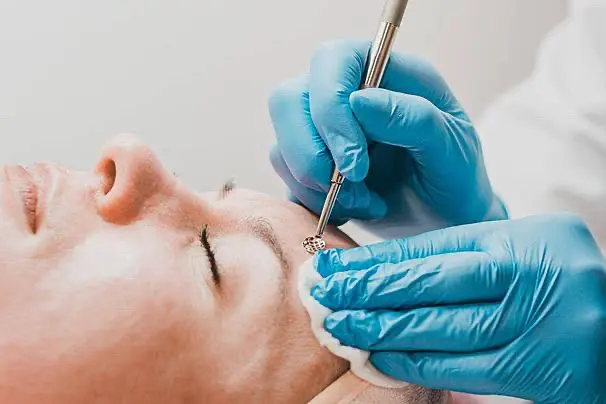 Limpieza Facial Mecánica