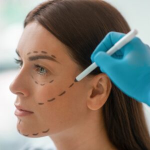 Adipoestructuración Facial