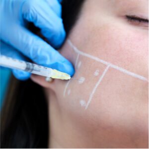 Toxina para bruxismo